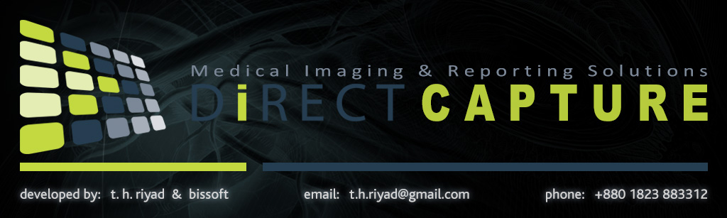 Loading DiRECT CAPTURE